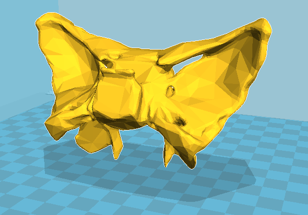 sphenoid.png